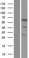 PDE1B Protein (Over-Expression Lysate Myc-DDK (Flag))
