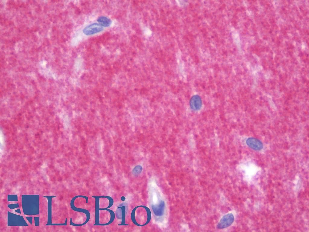 IHC-plus™ PRRT2 Antibody