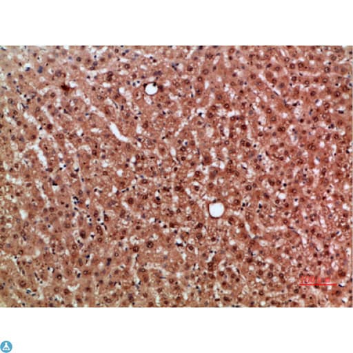 Polyclonal Rabbit anti-Human NOX1 Antibody (IHC, WB)