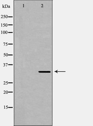 HADH Antibody