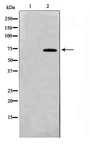 RELA / NFKB p65 Antibody