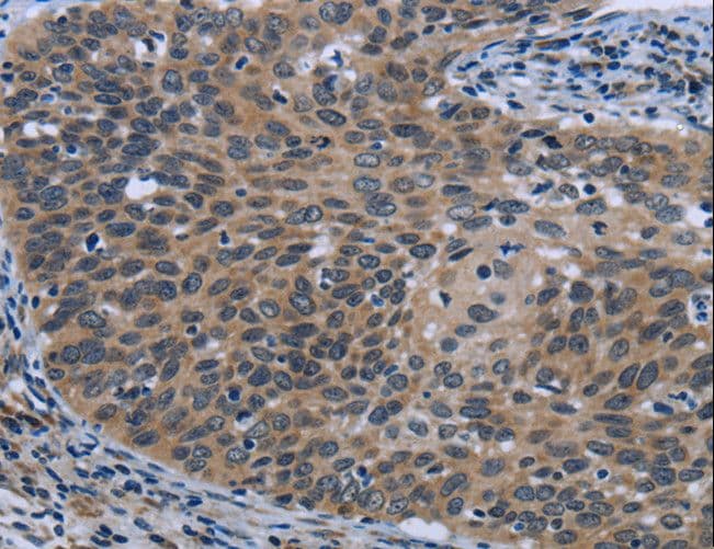 Polyclonal Rabbit anti-Human AVEN / PDCD12 Antibody (IHC, WB)