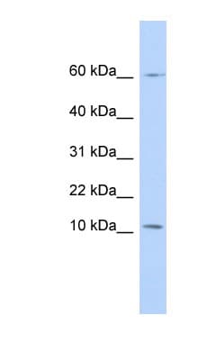 Polyclonal Rabbit anti-Human PI3 / Elafin Antibody (N-Terminus, WB)