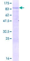Human NOC4L Protein (Recombinant GST)