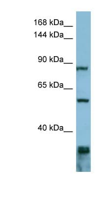 EPS8 Antibody (aa647-696)
