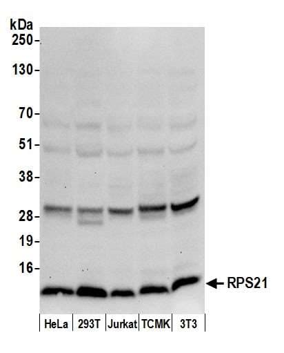 Polyclonal Rabbit anti-Human RPS21 / Ribosomal Protein S21 Antibody (aa33-83, WB)