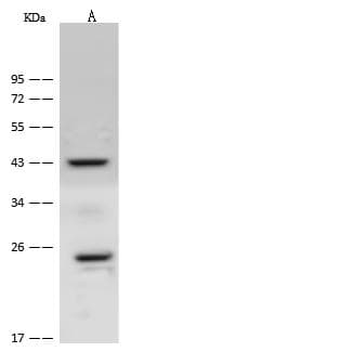 Polyclonal Rabbit anti-Human CACNG1 / CACNG Antibody (WB)