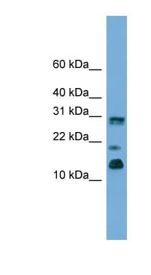 PEA15 / PEA-15 Antibody (C-Terminus)