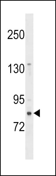 ZNF853 Antibody (aa125-151)