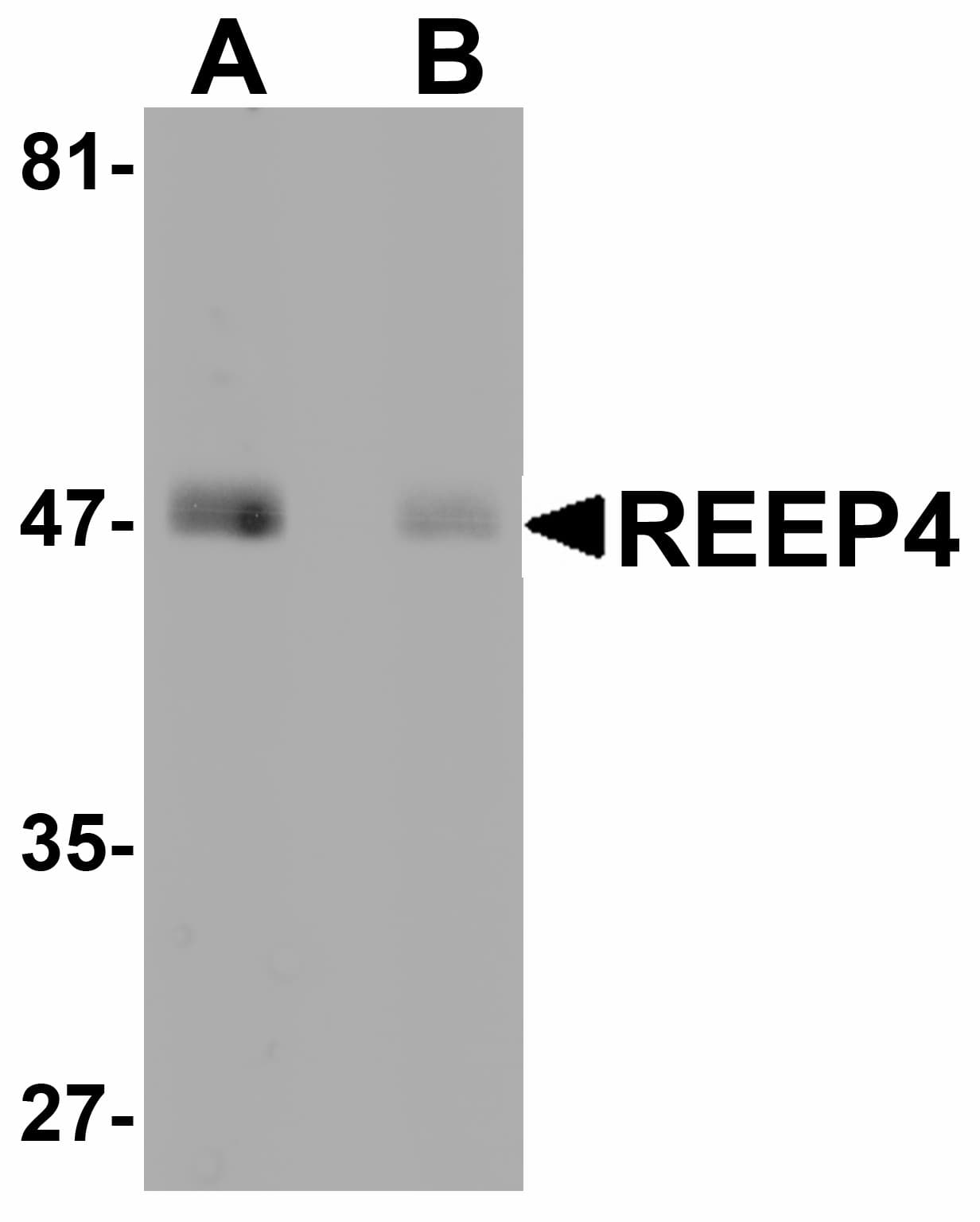 Polyclonal Rabbit anti-Human REEP4 Antibody (WB)