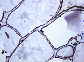 Monoclonal Mouse anti-Human ABCB1 / MDR1 / P Glycoprotein Antibody (clone OTI5B3, IHC)