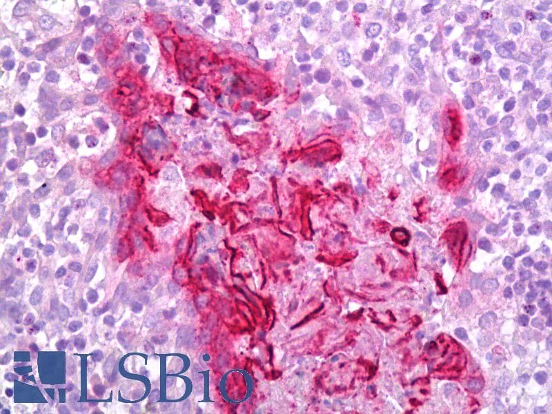 IHC-plus™ Polyclonal Rabbit anti-Human TGM1 / Transglutaminase Antibody (IHC, WB)