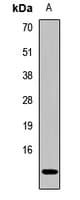 Polyclonal Rabbit anti-Human CKS2 Antibody (WB)