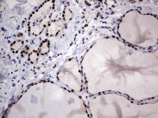 Monoclonal Mouse anti-Human DDX56 Antibody (clone UMAB152, Carrier-free, aa323-547, IHC, IF, WB)