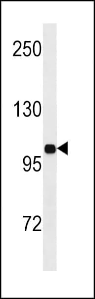 INSR / Insulin Receptor Antibody (aa826-854)