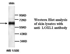 Polyclonal Rabbit anti-Human LOXL1 Antibody (WB)