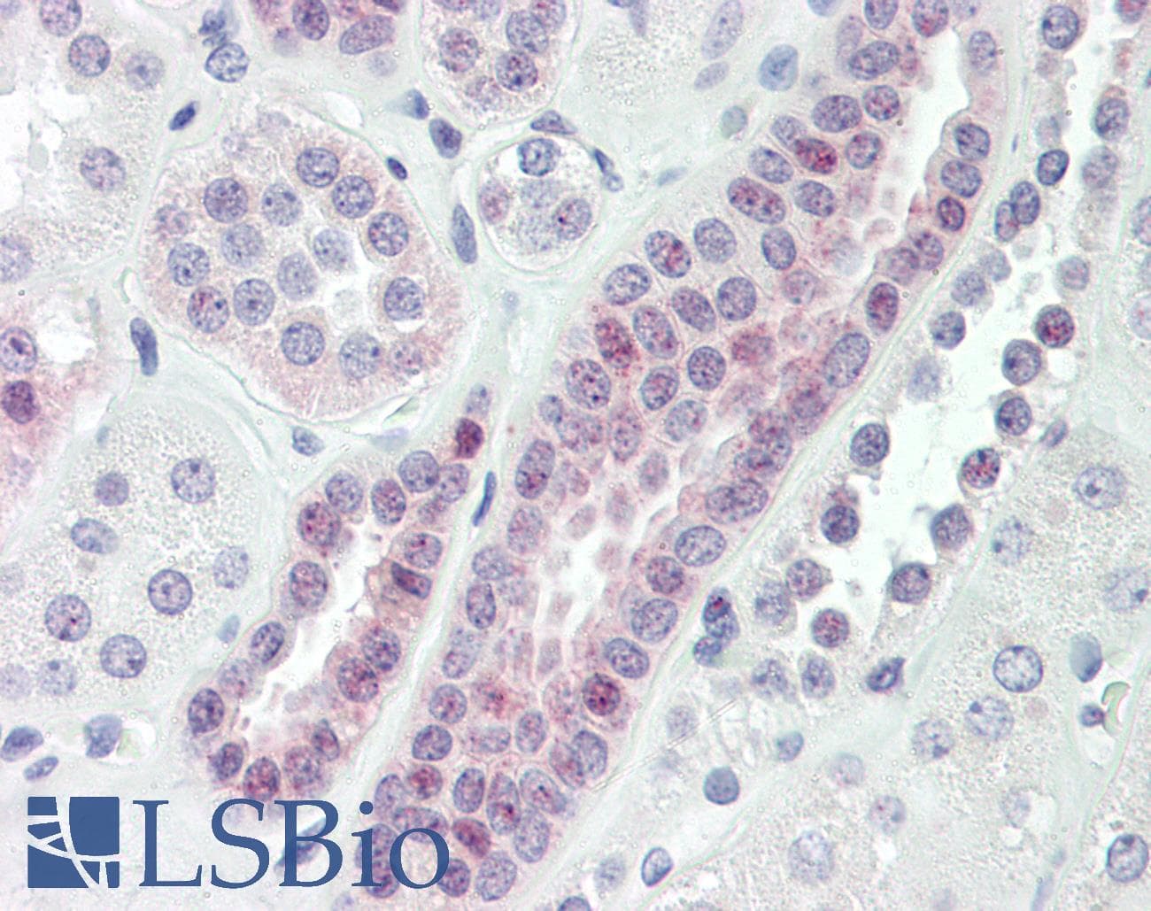 IHC-plus™ VPS72 Antibody (aa131-180)
