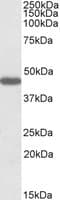 IHC-plus™ PROKR2/Prokineticin Receptor 2 Antibody (aa5-15)