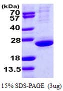 Human CLPP Protein (Recombinant)