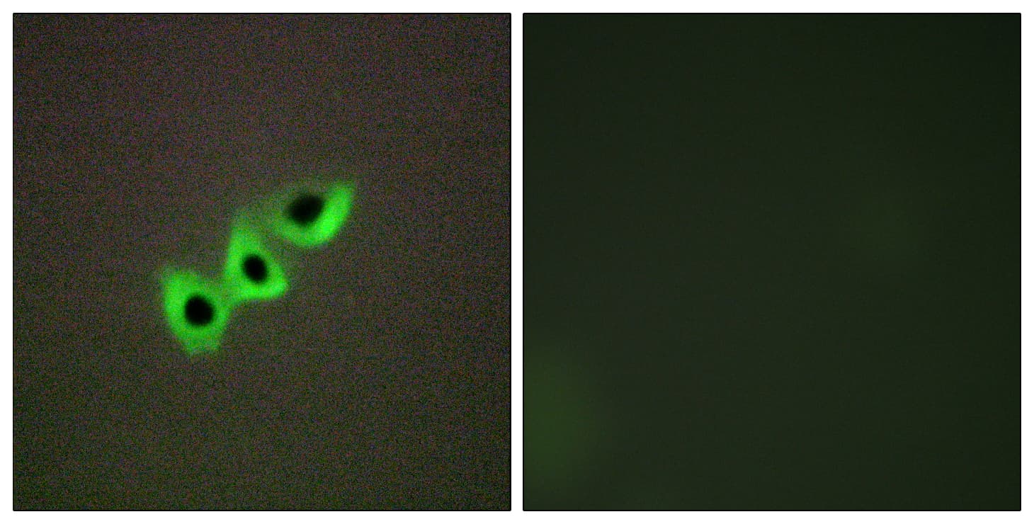 DLC1 Antibody (aa61-110)