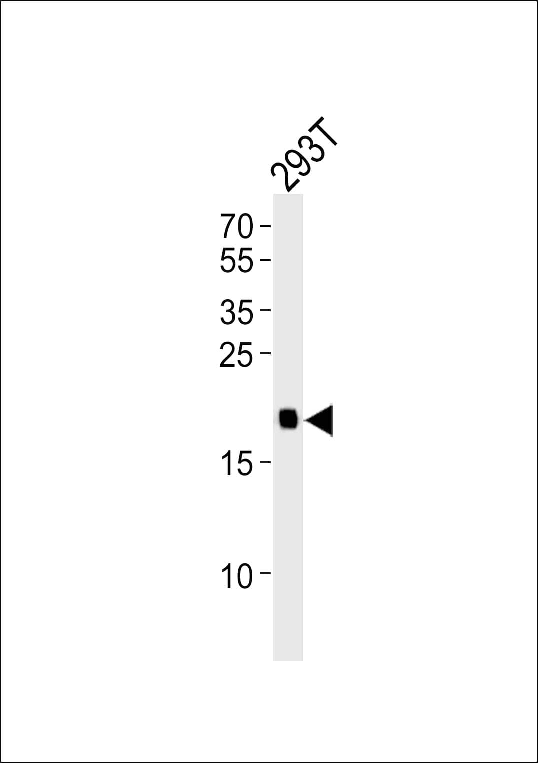 HRAS / H-Ras Antibody (aa104-128)