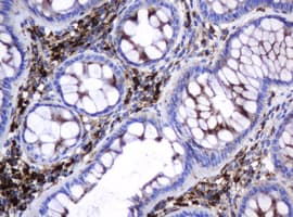 GLB1 / Beta-Galactosidase Antibody (clone OTI1C9)