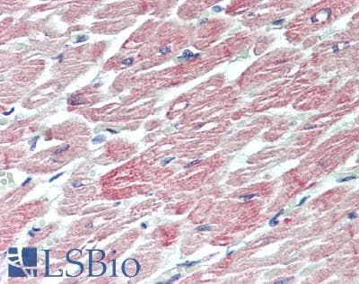 IHC-plus™ ACTC1 / Alpha Cardiac Actin Antibody (1-80 aa, N-terminal)