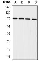 IL27RA Antibody (Internal)