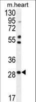 RNF183 Antibody (aa86-114)
