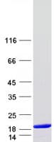 Human DYNLT3 Protein (Recombinant Myc-DDK (Flag))