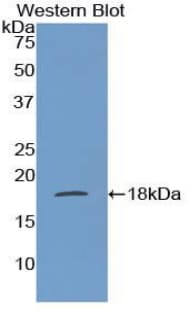 FABP1 / L-FABP Antibody (aa1-127)