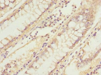 UBXD9 / ASPL Antibody