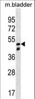 Polyclonal Rabbit anti-Human SNX8 Antibody (aa318-344, WB)