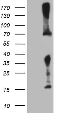GALNT10 Antibody (aa1-318, clone OTI4F11, Carrier-free)