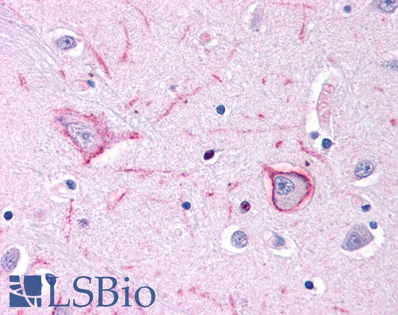 TACR1 / NK1R Antibody (N-Terminus, DY650)