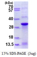 Human DNAJC12 Protein (Recombinant His)