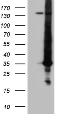 RAB23 Antibody (aa1-234, clone OTI2A8)
