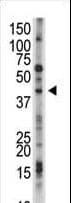 USP12 Antibody (aa5-35)