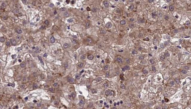 OR1J1 Antibody