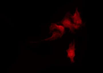 ADD1 / Adducin Alpha Antibody (phospho-Ser726)