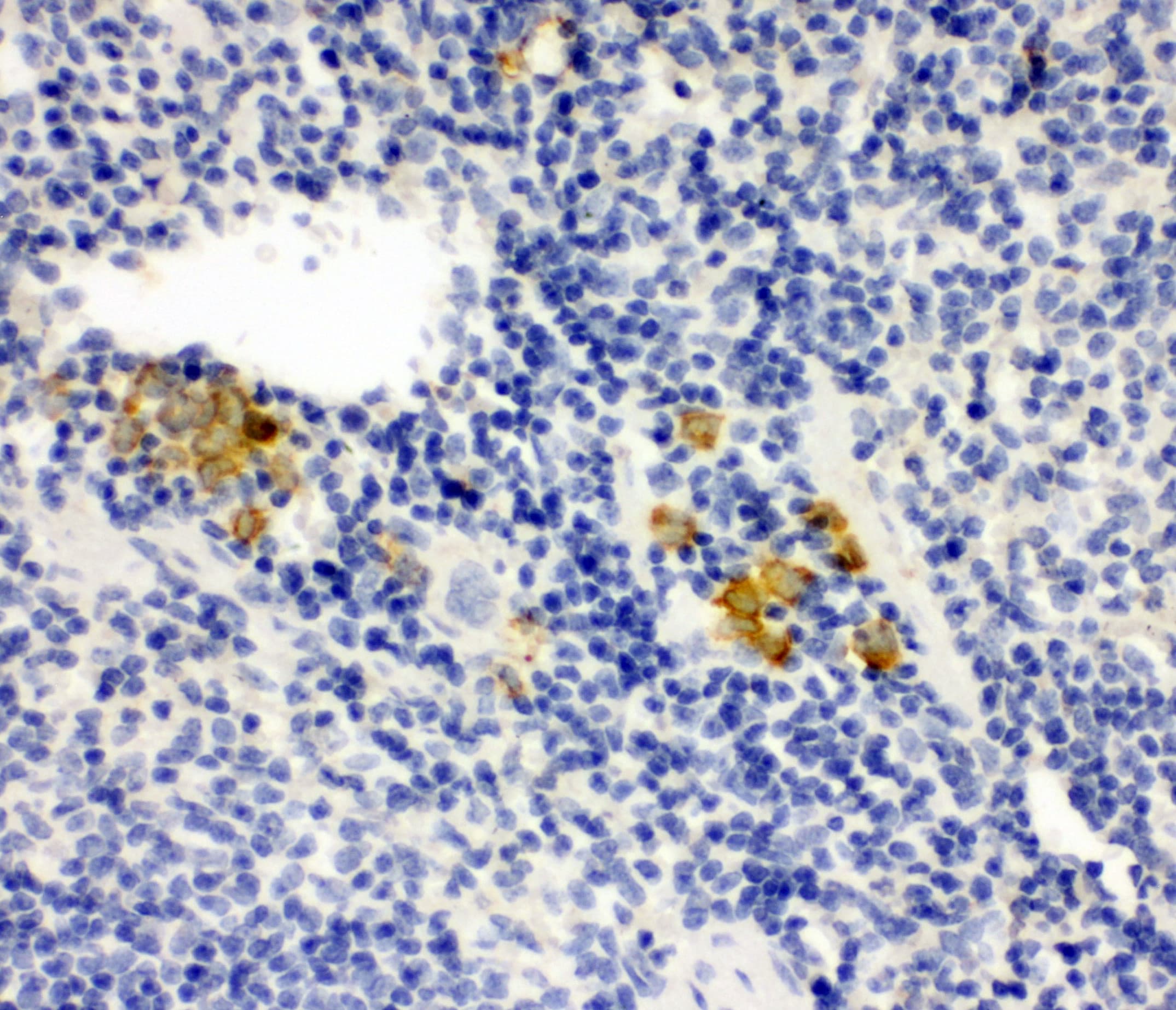 Polyclonal Rabbit anti-Human LPXN / Leupaxin Antibody (aa115-129, IHC, WB)