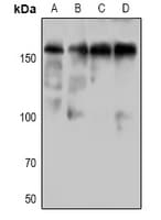 Polyclonal Rabbit anti-Human DAPK1 / DAP Kinase Antibody (WB)