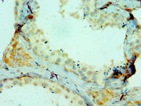 Polyclonal Rabbit anti-Human COL10A1 / Collagen X Antibody (aa521-680, IHC)