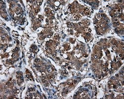 LIPG / Endothelial Lipase Antibody (clone OTI4A8)