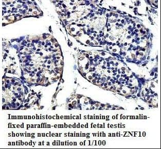ZNF10 / KOX1 Antibody (aa20-242)