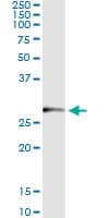 Monoclonal Mouse anti-Human TRIM72 / MG53 Antibody (clone 3B5)