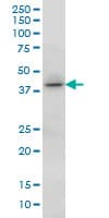 Monoclonal Mouse anti-Human HOXC13 Antibody (clone 10D4, WB)