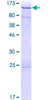 Human AHI1 Protein (Recombinant GST)