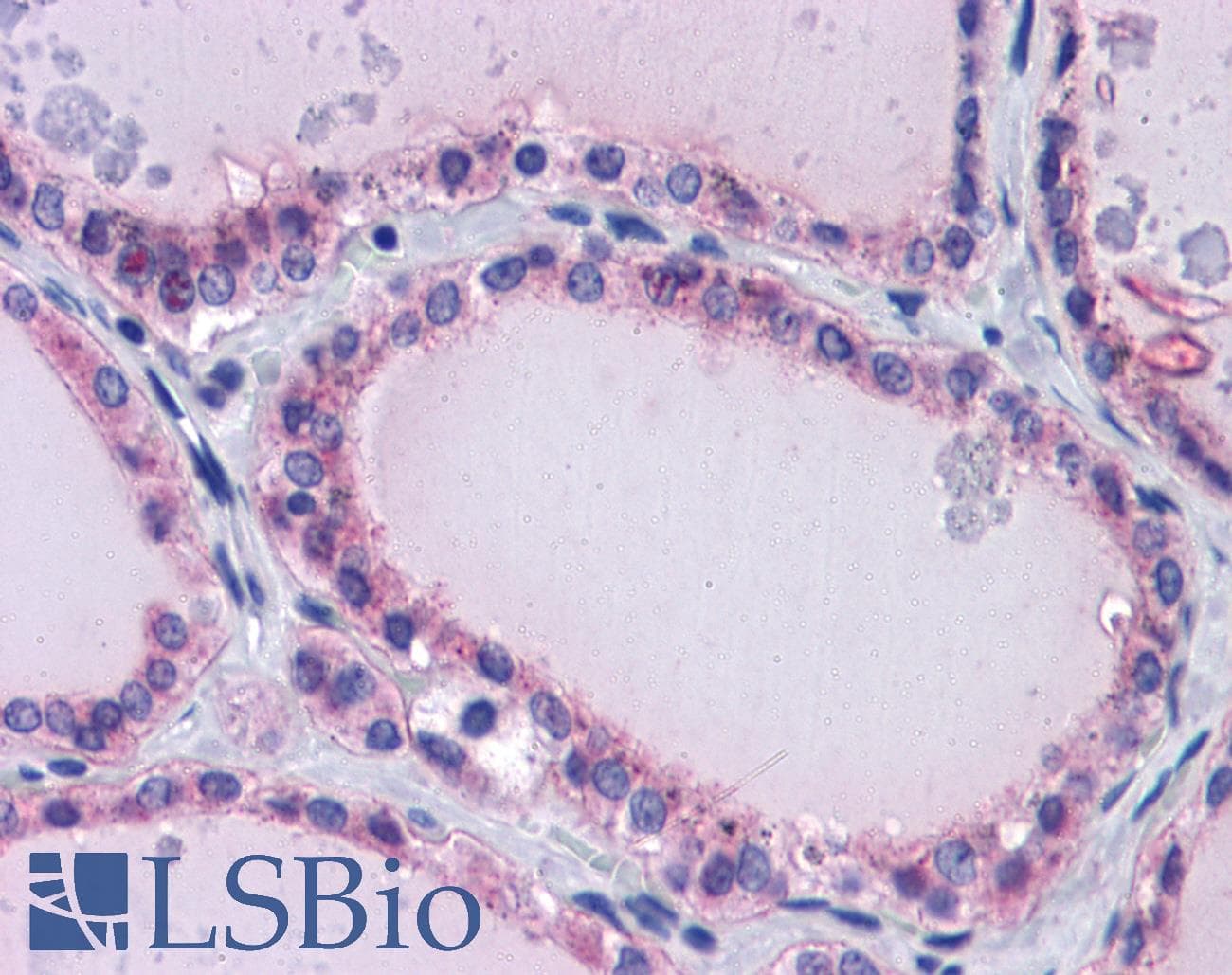 Polyclonal Rabbit anti-Human PAX8 Antibody (aa215-264, IHC, WB)