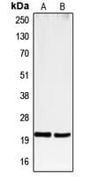 CD3E Antibody (Internal)